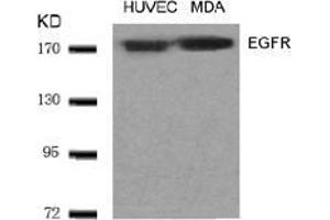 Image no. 1 for anti-Epidermal Growth Factor Receptor (EGFR) (AA 1068-1072) antibody (ABIN197228) (EGFR anticorps  (AA 1068-1072))