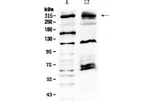Western blot analysis of MED13 using anti-MED13 antibody . (MED13 anticorps  (AA 61-240))