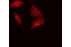 ABIN6279204 staining Hela cells by IF/ICC. (BCCIP anticorps  (C-Term))
