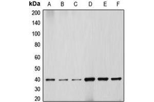 Western blot analysis of HSP40 expression in HEK293T (A), HeLa (B), NIH3T3 (C), PC12 (D), Jurkat (E), HepG2 (F) whole cell lysates. (DNAJB1 anticorps  (C-Term))
