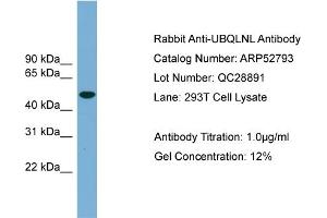 WB Suggested Anti-UBQLNL  Antibody Titration: 0. (UBQLNL anticorps  (Middle Region))