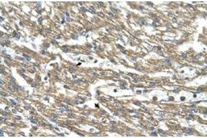 Immunohistochemical staining (Formalin-fixed paraffin-embedded sections) of human heart with CTH polyclonal antibody  at 4-8 ug/mL working concentration. (CTH anticorps  (C-Term))
