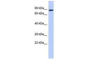 Image no. 1 for anti-Zinc Finger, FYVE Domain Containing 20 (ZFYVE20) (N-Term) antibody (ABIN6742873) (Rabenosyn 5 anticorps  (N-Term))