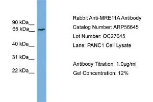 WB Suggested Anti-MRE11A  Antibody Titration: 0. (Mre11 anticorps  (Middle Region))