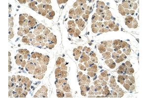 KLHL31 antibody was used for immunohistochemistry at a concentration of 4-8 ug/ml to stain Skeletal muscle cells (arrows) in Human Muscle. (KLHL31 anticorps)