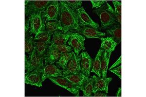 Immunofluorescent staining of methanol-fixed HeLa cells. (Cytokeratin 7 anticorps)