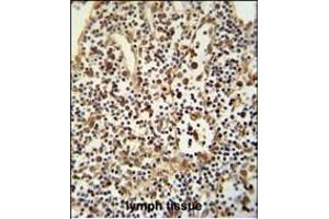 ANO5 Antibody (C-term) (ABIN652521 and ABIN2842350) immunohistochemistry analysis in formalin fixed and paraffin embedded human lymph tissue followed by peroxidase conjugation of the secondary antibody and DAB staining. (Anoctamin 5 anticorps  (C-Term))