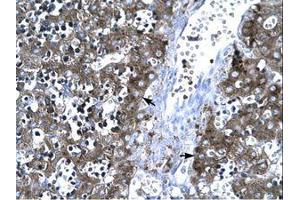 Image no. 3 for anti-Matrix Metallopeptidase 19 (MMP19) (AA 349-398) antibody (ABIN202685)