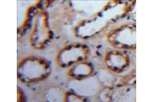 Used in DAB staining on fromalin fixed paraffin-embedded kidney tissue (PKC alpha anticorps  (AA 339-597))