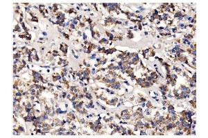 IHC analysis of PFKFB2 using anti-PFKFB2 antibody (ABIN7601627). (PFKFB2 anticorps  (AA 4-505))