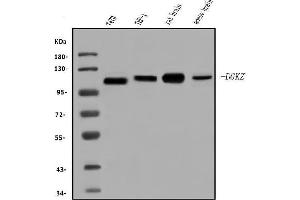 Western blot analysis of DGKZ/DGK-zeta using anti-DGKZ/DGK-zeta antibody (ABIN7602261). (DGKZ anticorps  (AA 664-928))
