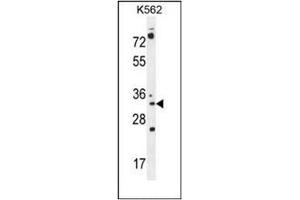 Western blot analysis of PYCR2 Antibody (Center) in K562 cell line lysates (35ug/lane).