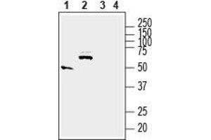 Western blot analysis of rat small intestine (lanes 1 and 3) and brain (lanes 2 and 4) lysates: - 1,2. (Solute Carrier Family 17 (Acidic Sugar Transporter), Member 5 (SLC17A5) (AA 479-492), (C-Term), (Intracellular) anticorps)
