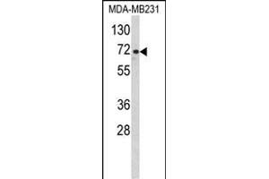 Western blot analysis of ARHG Antibody (Center) (ABIN652455 and ABIN2842309) in MDA-M cell line lysates (35 μg/lane). (ARHGAP18 anticorps  (AA 180-207))