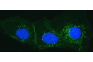 IF analysis of Tissue Factor using anti-Tissue Factor antibody (ABIN3042382).
