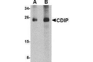 Western Blotting (WB) image for anti-LITAF-Like Protein (CDIP1) (Middle Region 1) antibody (ABIN1031187) (CDIP1 anticorps  (Middle Region 1))