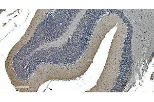 anti-LSM7 Homolog, U6 Small Nuclear RNA Associated (LSM7) (AA 1-103) antibody