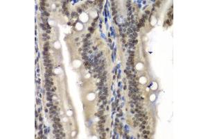 Immunohistochemistry of paraffin-embedded mouse Intestine using NELFE antibody at dilution of 1:100 (x40 lens). (RDBP anticorps)