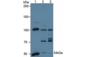 Western blot analysis of (1) Human A431 Cells, (2) Human HeLa cells and (3) Porcine Heart Tissue. (PDHX anticorps  (AA 220-468))