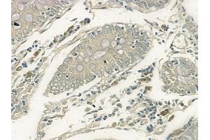 ABIN6260603 and ABIN6266446 at 1/100 staining human normal colon tissue by IHC-P. (CD28 anticorps  (C-Term))