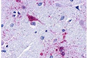 Anti-EDG7 antibody  ABIN1048536 IHC staining of human brain, amygdala. (LPAR3 anticorps  (Cytoplasmic Domain))