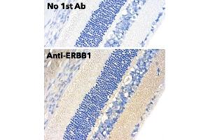 Immunohistochemistry (IHC) image for anti-Epidermal Growth Factor Receptor (EGFR) (C-Term) antibody (ABIN6254171) (EGFR anticorps  (C-Term))