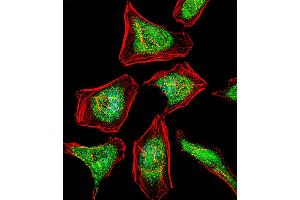 Fluorescent confocal image of Hela cell stained with ATF7 Antibody (N-term). (AFT7 anticorps  (N-Term))