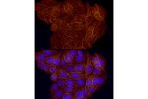 Immunofluorescence analysis of HeLa cells using CD146/MCAM Rabbit pAb (ABIN6127568, ABIN6143621, ABIN6143622 and ABIN6218100) at dilution of 1:50 (40x lens). (MCAM anticorps  (AA 447-646))