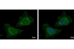 ICC/IF Image RABGGTB antibody detects RABGGTB protein at cytoplasm by immunofluorescent analysis. (RABGGTB anticorps)