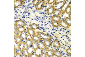 Immunohistochemistry of paraffin-embedded mouse kidney using TOMM20 antibody. (TOMM20 anticorps  (AA 20-145))