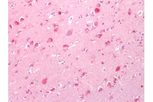 Human Brain, Cortex: Formalin-Fixed, Paraffin-Embedded (FFPE)