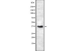 Western blot analysis of CEACAM6 using COLO205 whole cell lysates (CEACAM6 anticorps)
