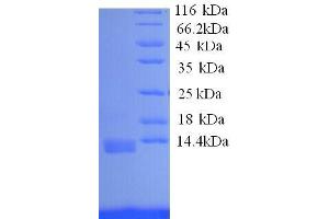 Interleukin 8 (IL8) (AA 23-101), (full length) protein (His tag)