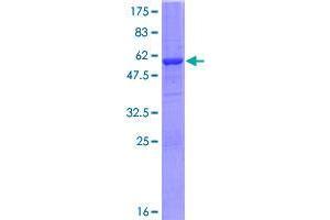 Image no. 1 for Glucosamine-6-Phosphate Deaminase 2 (GNPDA2) (AA 1-276) protein (GST tag) (ABIN1355435)
