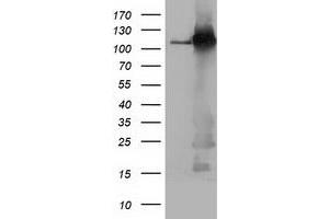 Western Blotting (WB) image for anti-Budding Uninhibited By Benzimidazoles 1 Homolog beta (Yeast) (BUB1B) antibody (ABIN1496997) (BUB1B anticorps)