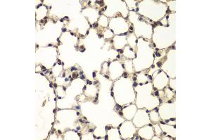 Immunohistochemistry of paraffin-embedded mouse lung using PHF11 antibody. (PHF11 anticorps)