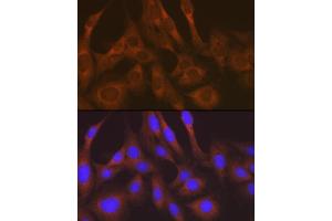 Immunofluorescence analysis of C6 cells using LysRS/KARS Rabbit mAb (ABIN7268350) at dilution of 1:100 (40x lens). (KARS anticorps)