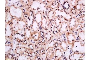 Paraformaldehyde-fixed, paraffin embedded human kidney, Antigen retrieval by boiling in sodium citrate buffer (pH6) for 15min, Block endogenous peroxidase by 3% hydrogen peroxide for 30 minutes, Blocking buffer (normal goat serum) at 37°C for 20min, Antibody incubation with Rabbit Anti-MOT8/SLC16A2 Polyclonal Antibody, Unconjugated  at 1:200 overnight at 4°C, followed by a conjugated secondary for 90 minutes and DAB staining.