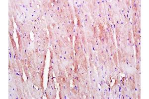 Paraformaldehyde-fixed, paraffin embedded Mouse heart, Antigen retrieval by boiling in sodium citrate buffer (pH6.