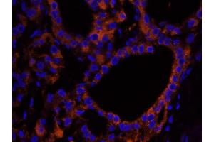 Immunofluorescence (IF) image for anti-Neurofibromin 2 (NF2) (C-Term) antibody (ABIN7448991) (Merlin anticorps  (C-Term))