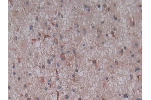 Detection of C5a in Human Glioma Tissue using Polyclonal Antibody to Complement Component 5a (C5a)