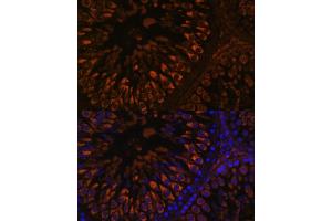 Immunofluorescence analysis of rat testis using FER1L5 antibody (ABIN7267166) at dilution of 1:100. (FER1L5 anticorps  (AA 1350-1670))
