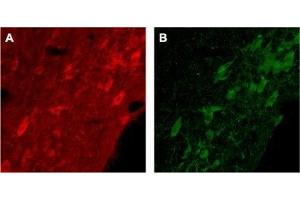 Expression of p75NTR in rat brain - Immunohistochemical staining of rat brain with Anti-p75 NGF Receptor (extracellular) Antibody (ABIN7043344, ABIN7044755 and ABIN7044756). (NGFR anticorps  (Extracellular, Stalk Region))