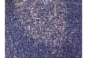 Image no. 3 for anti-Diacylglycerol Kinase, alpha 80kDa (DGKA) antibody (ABIN1497815) (DGKA anticorps)