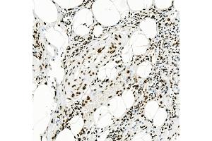 IHC analysis of KAP1/TRIM28 using anti-KAP1/TRIM28 antibody (ABIN7602310). (KAP1 anticorps  (AA 699-835))