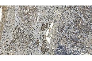 IHC analysis of RGS6 using anti-RGS6 antibody (ABIN7602326). (RGS6 anticorps  (AA 7-357))