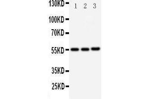 Western Blotting (WB) image for anti-Kallikrein 2 (KLK2) (AA 243-261), (C-Term) antibody (ABIN3043140)