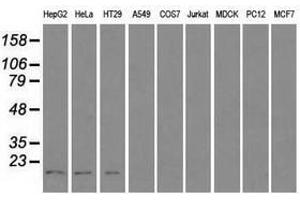 Image no. 2 for anti-Cancer/testis Antigen 1B (CTAG1B) antibody (ABIN1499904) (CTAG1B anticorps)