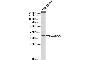 Western blot analysis of extracts of various cell lines, using SLC25 antibody (ABIN6129250, ABIN6147917, ABIN6147919 and ABIN6218142) at 1:440 dilution. (SLC25A20 anticorps  (AA 1-301))