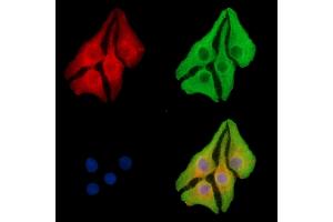 SPNS1 Antibody staining Hela cells by IF/ICC. (SPNS1/Spinster 1 anticorps)